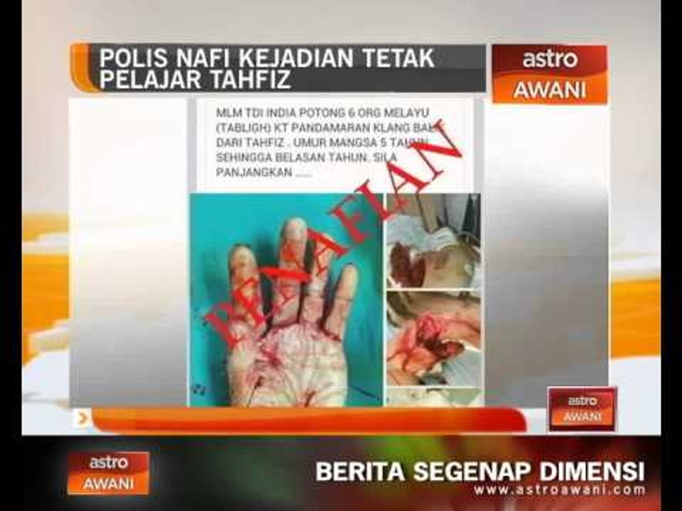 Polis nafi kejadian tetak pelajar tahfiz