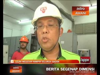 Lelaki cuba curi kabel elektrik melecur hampir seluruh badan