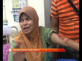 Penoreh getah parah disondol babi hutan