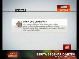 'Fake Braces' hanya trend dan suka-suka?