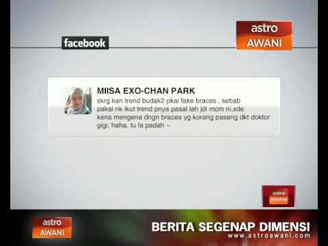 'Fake Braces' hanya trend dan suka-suka?