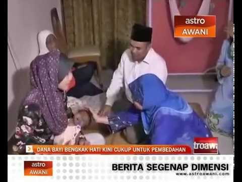Dana bayi bengkak hati kini cukup untuk pembedahan