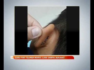 Guru piat telinga murid, luka sampai berjahit
