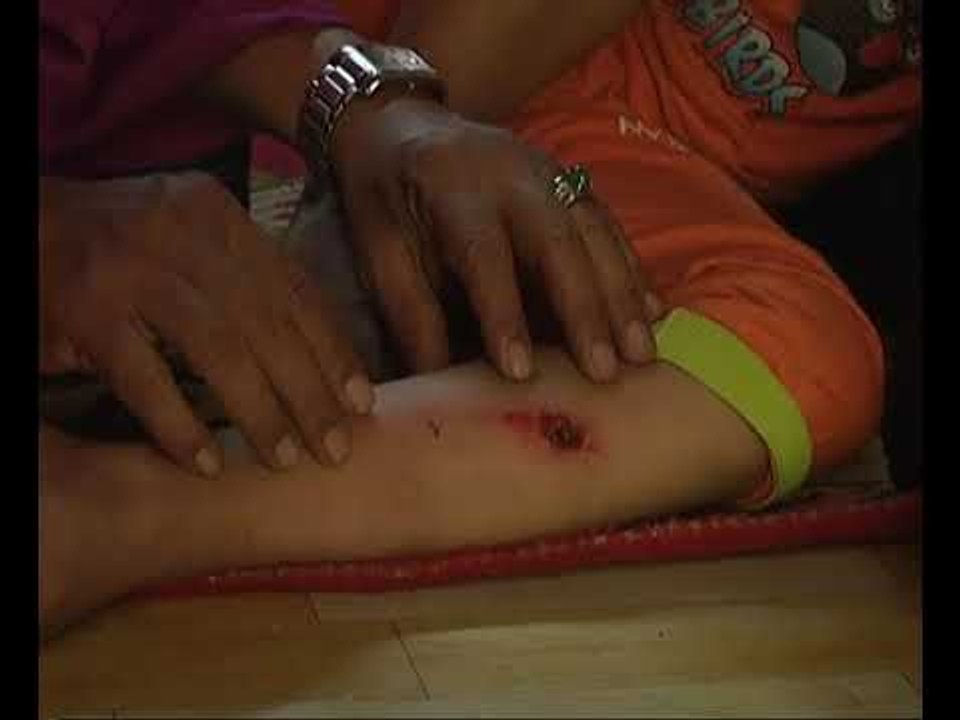 Kanak-kanak 8 tahun didera bapa kandung