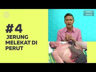 Kompak (Episod 25)