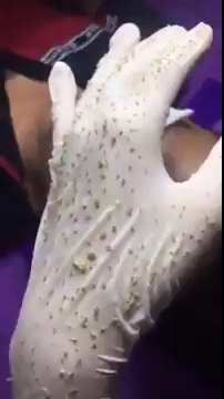 Những pha nặn mụn nhìn thôi cũng thấy đã