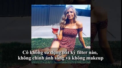 Hot girl Instagram đăng ảnh mặt mụn để các cô gái khác đỡ tự ti