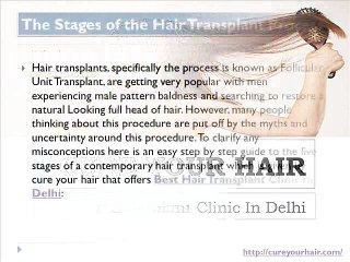 Best Hair Transplant Clinic In Delhi