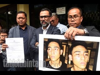 Jeremy Thomas Tunjukkan Foto Luka Anaknya