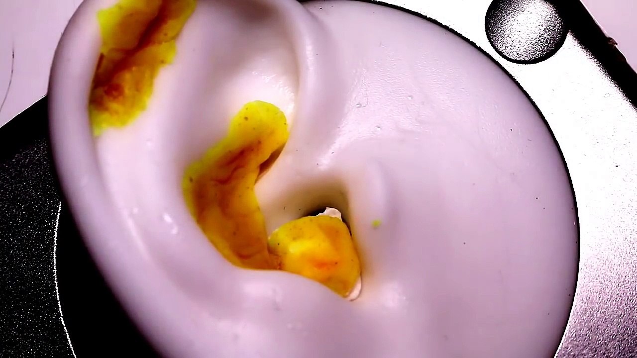 [아빠ASMR]한국어｜귀,뇌 자극 동네 의사 롤플레이 ✔doctor✔Role play✔ASMR✔ Whispering✔Scratching