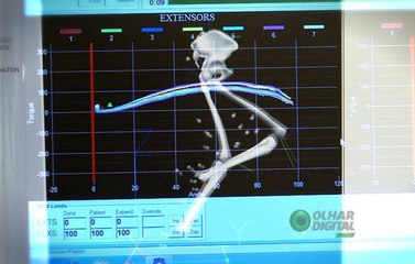Confira o que há de mais novo na tecnologia da medicina esportiva