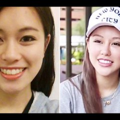 കാമുകന് വേണ്ടി ഉപേക്ഷിച്ച മുഖം...!!!