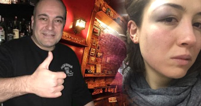 Müşterileri Demir Sopayla Döven Bar Sahibi, Kasten Yaralama Suçundan Tutuklandı