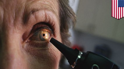 Woman gets crescent-shaped eye damage from staring at eclipse