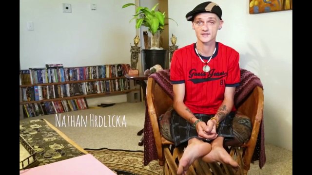 A pitiful man who was born without a thigh, as he was a good friend, met true lovers on Facebook