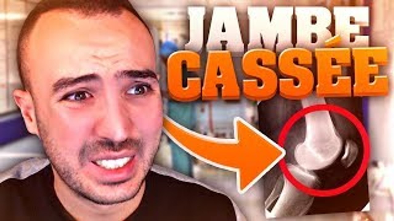 LE BLED'ART-JE ME SUIS CASSÉ LA JAMBE !