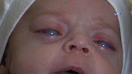 Minik "İkranur" Görmek İçin Destek Bekliyor