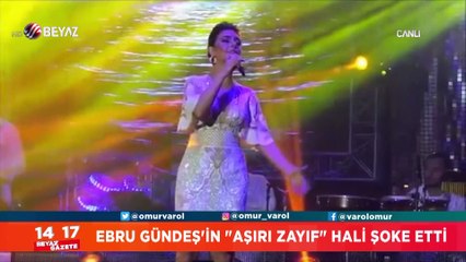 Ebru Gündeş'in ''Aşırı Zayıf'' hali şoke etti