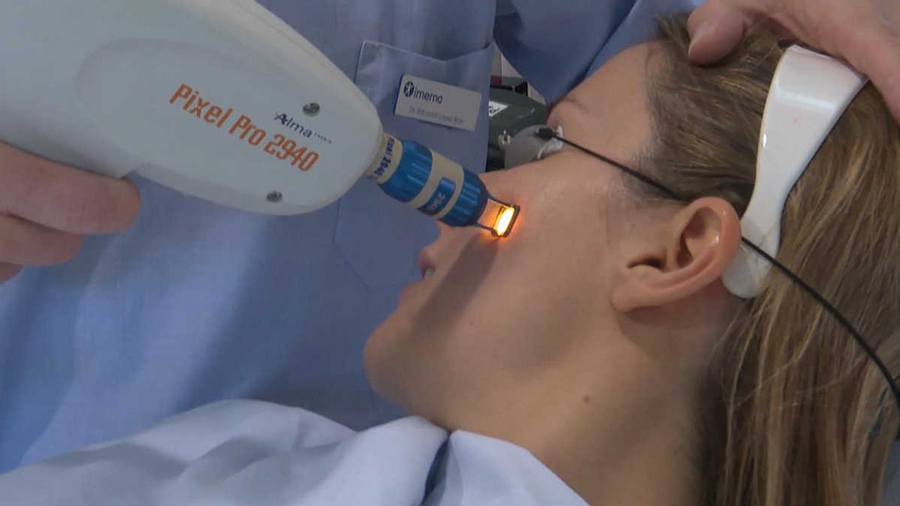 "Bye bye" a las cicatrices del acné