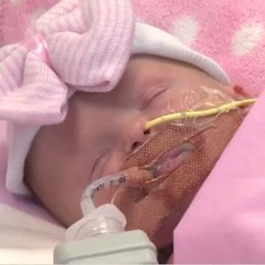 Un bébé né avec son coeur hors de la poitrine opéré avec succès en Angleterre
