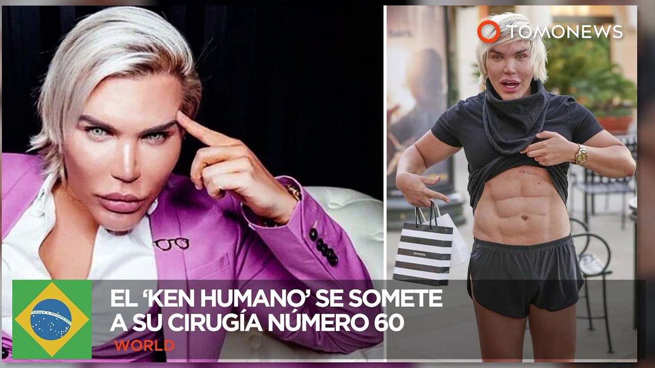 Cirugía plástica: El ‘Ken humano’ planea someterse a su cirugía número 60 - TomoNews