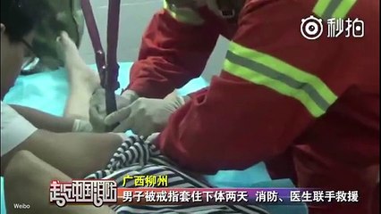 Chàng trai 18 tuổi bị kẹt "của quý" trong chiếc nhẫn suốt 2 ngày trời