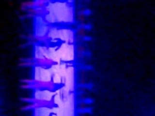 Show des 40 ans de l'ASNL