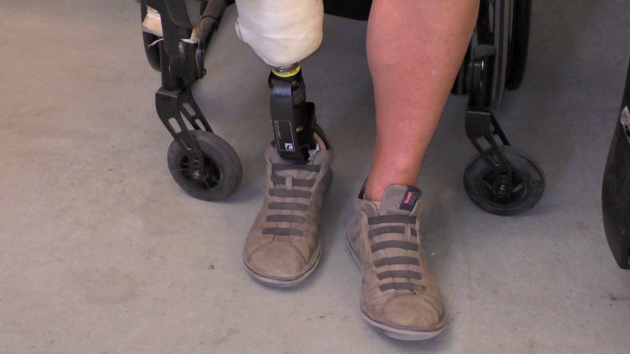 Ma vie prothésée