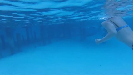 Elle se fait mordre par un requin pendant sa lune de miel...