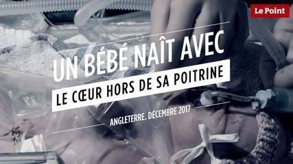 Un bébé naît avec le coeur hors de sa poitrine