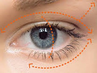 Blefaroplastia, la solución funcional y estética a los párpados deprimidos