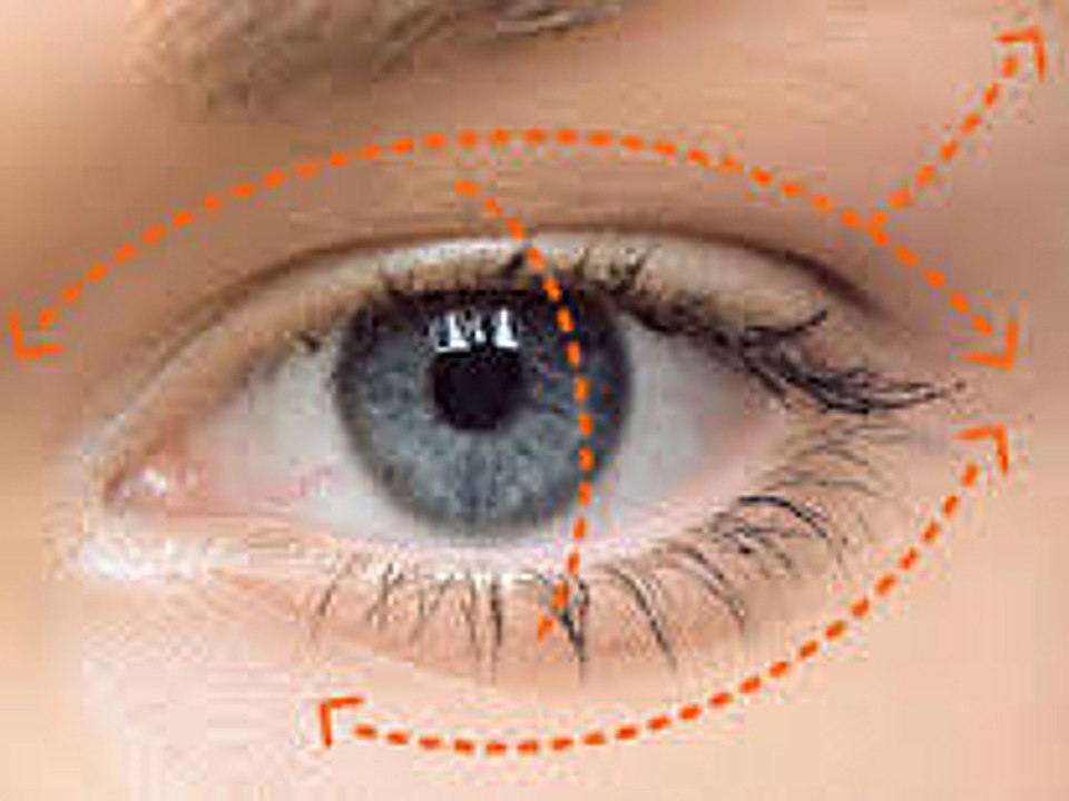 Blefaroplastia, la solución funcional y estética a los párpados deprimidos