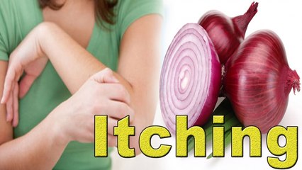 How to Remove Itching from your Skin