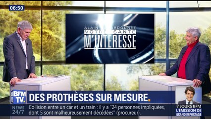 Des prothèses sur mesure