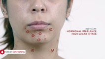 Causes of Spots On Different Areas Of The Body And What They Indicate-F0mVphxpG60