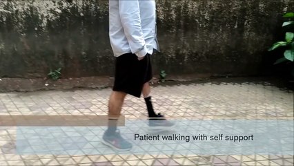 Best Artificial Limb Centres in Kochi