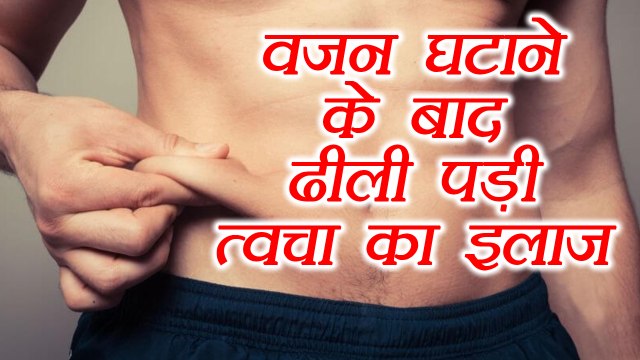 Tighten Loose Skin: वज़न कम होने के बाद ढीली पड़ी स्किन को दूर करने के उपाय | Boldsky