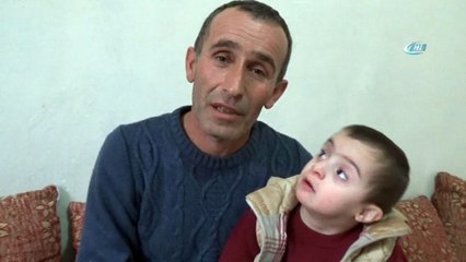 3 yaşındaki Malik Down sendromlu, kalbi delik ve guatr hastası