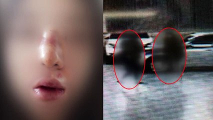 [단독] "남자 생겼냐" 무자비 폭행...또 '데이트 폭력' / YTN