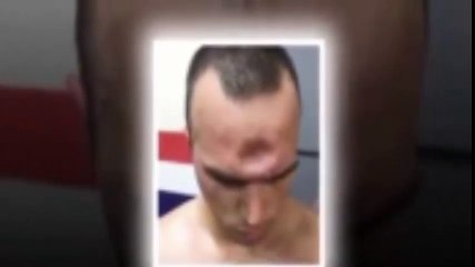 Son Dakika Haber Muay Thai Sporcusu, Yediği Dirsekten Sonra