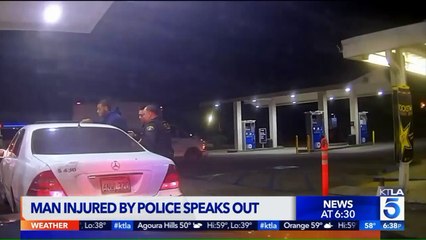 `I Complied with Everything They Asked Me:` Man Whose Leg Was Broken During Arrest Speaks Out