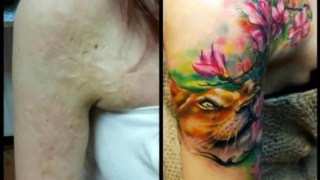 Amazing Scar-Covering Tattoos - Epic Cover Up-Y3fuFY-7M1E