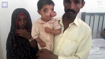 Pakistani toddler branded a ‘curse’ for ‘elephant trunk’ nose