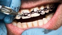 Have You Ever Seen Teeth Tattoos-Z3kI5uCVyhA