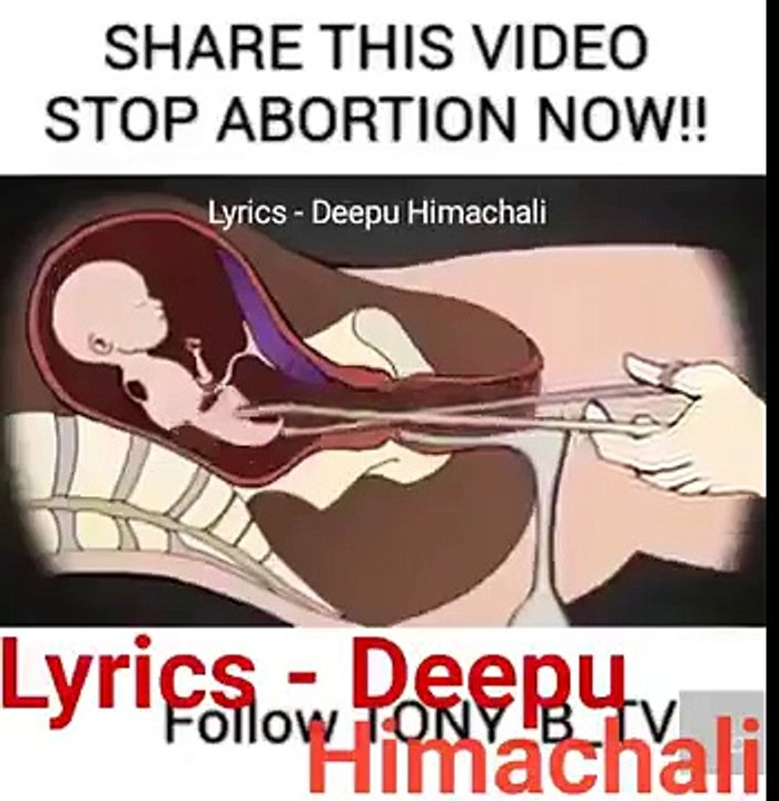 Share this abortion video... Stop abortion now...