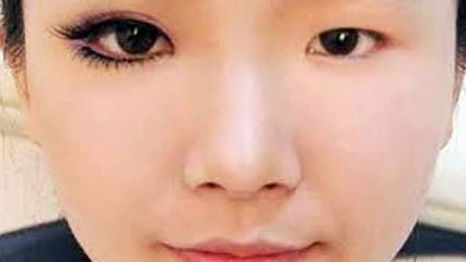 Con trai con gái đều có thể đi nhấn mí Hàn Quốc