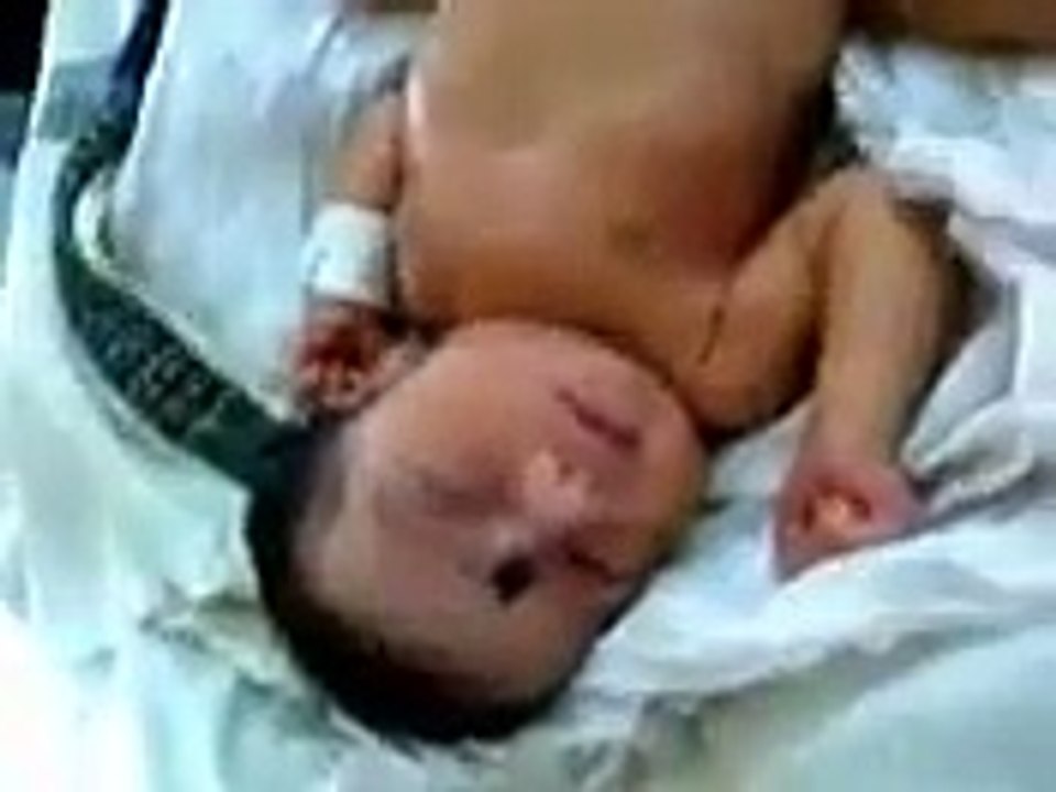 baby born with genuine problem