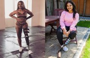 Empowered Teen Proud of Prosthetic Leg | SHAKE MY BEAUTY
