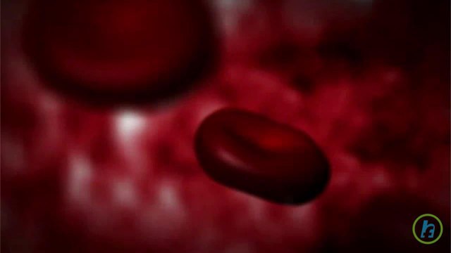 What is Myocardial Infarction?