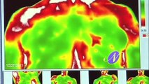 Breast Thermography Testing Cost in New York and NCY - Getintegrativehealth - Thermographyslutionny